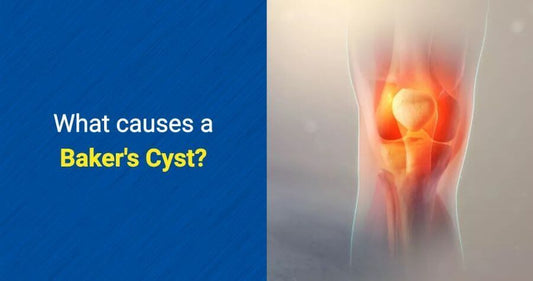 What causes a Baker's Cyst by OSMO Patch