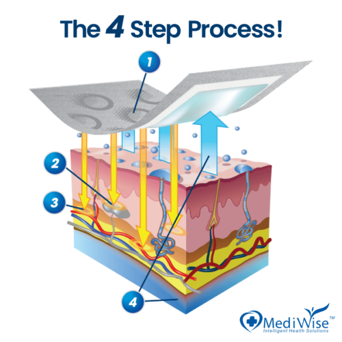 The 4 step process! The OSMO Patch applied on a dermal layer, indicating where the 4 steps of the process take place.