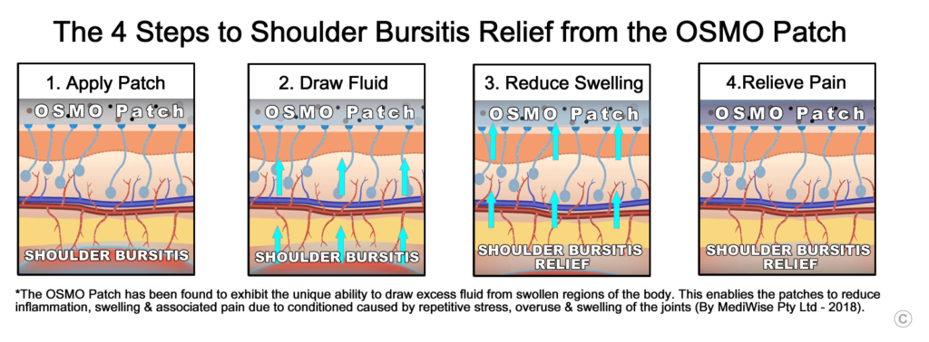 Shoulder Bursitis Relief - OSMO Patch